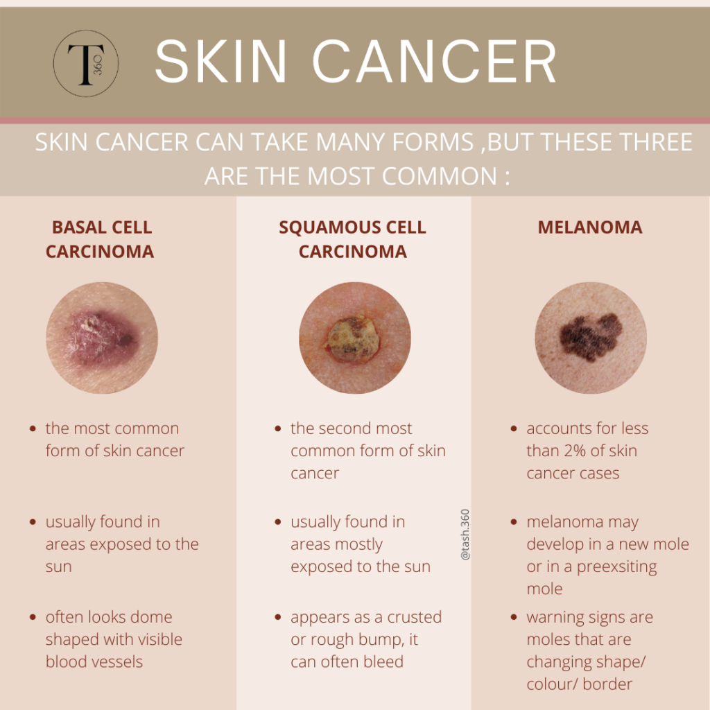 This Winter – Reduce your chances of getting Skin Cancer – TASH360